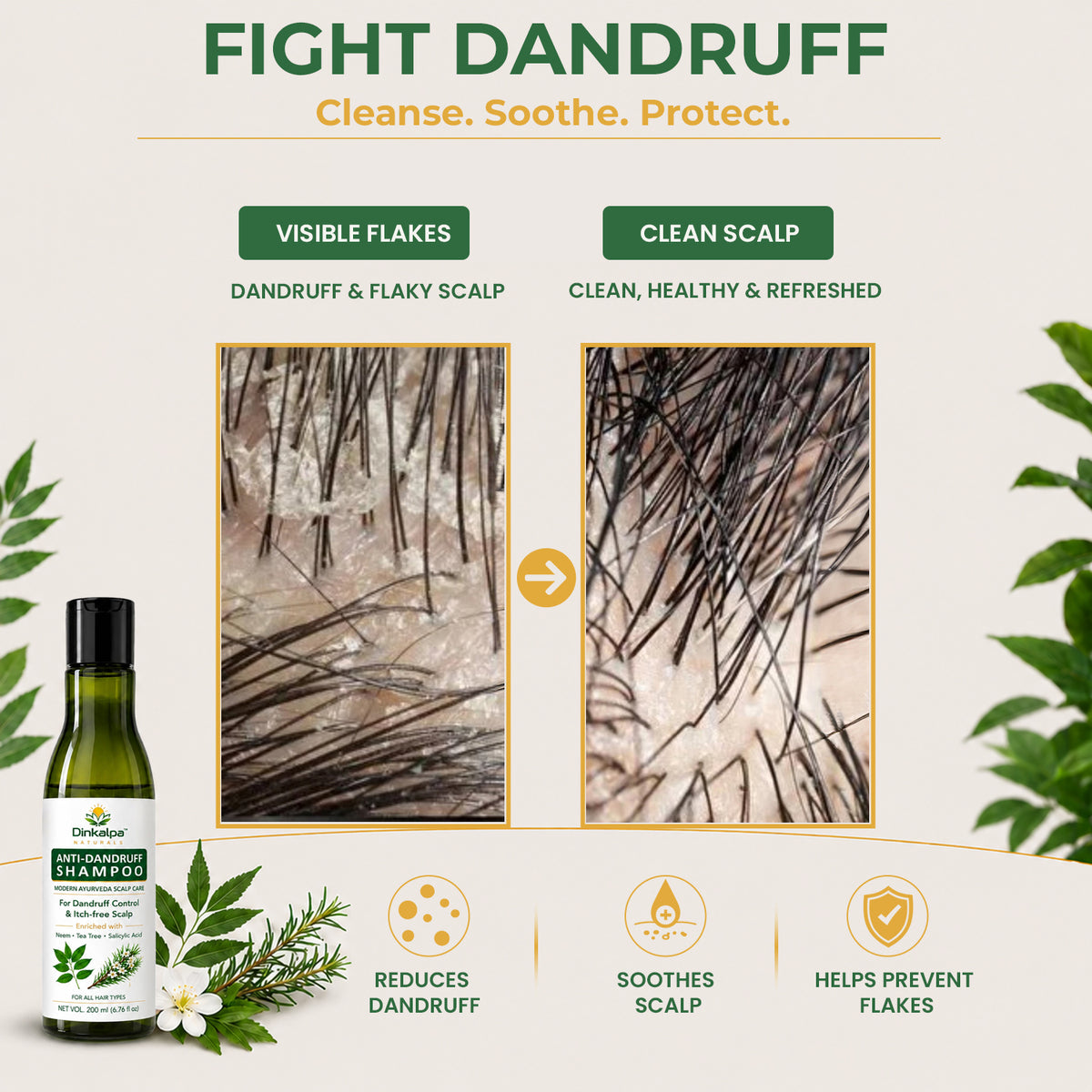 Anti-Dandruff Shampoo